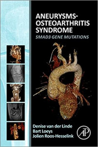 Aneurysms-osteoarthritis syndrome : SMAD3 gene mutations