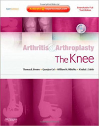 Arthritis &  Arthroplasty : the Knee