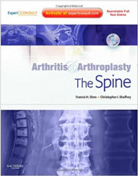 Arthritis & Arthroplasty : the Spine