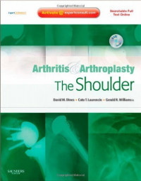 Arthritis & arthroplasty: the shoulder