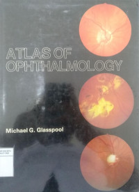 Atlas of ophthalmology