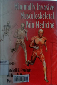 Minimally invasive musculoskeletal pain medicine