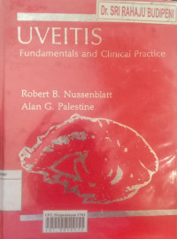 Uveitis: fundamentals and clinical practice