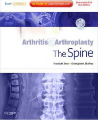 Arthritis & arthroplasty: the spine